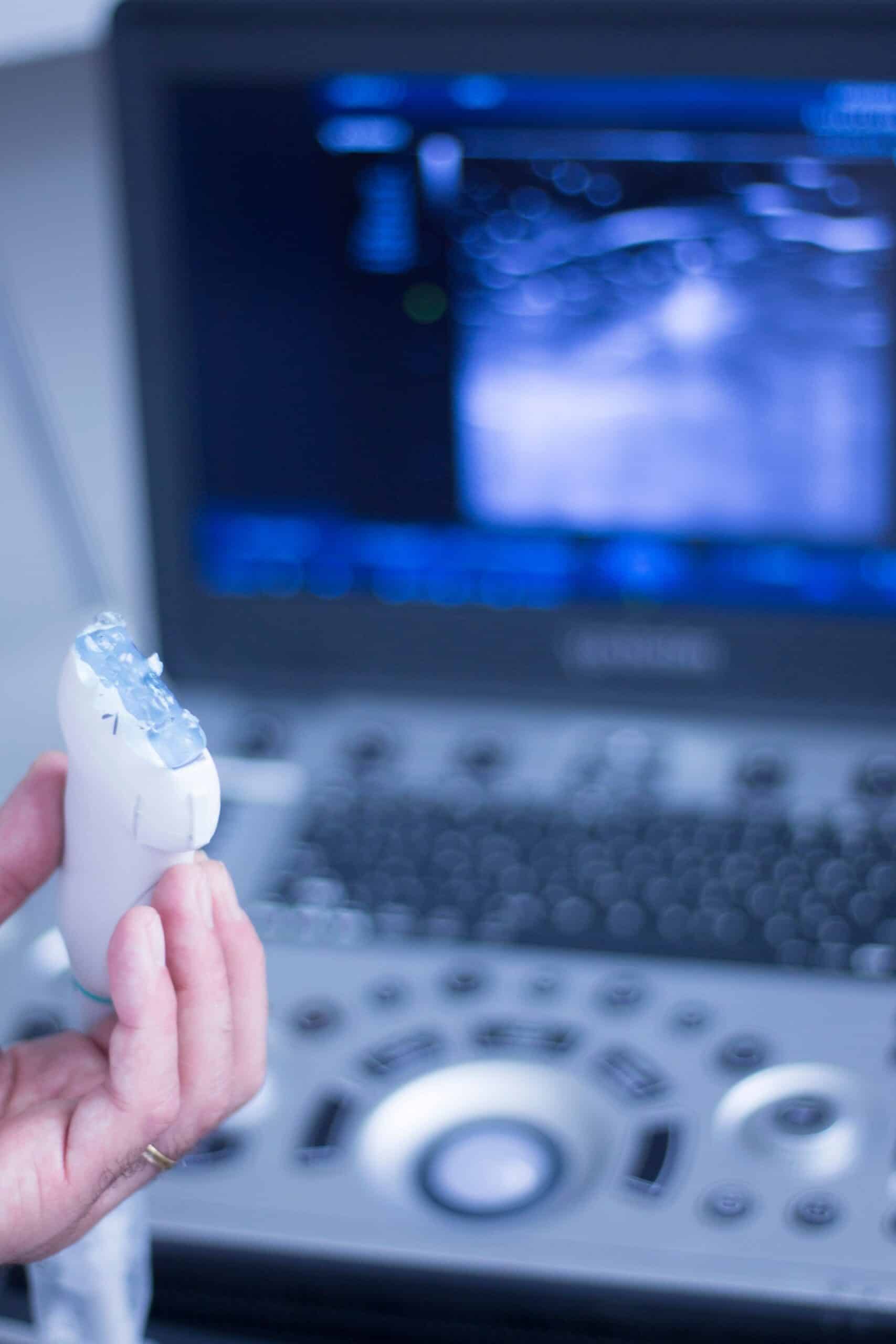 3D/4D-Sonografie und räumliche Darstellung